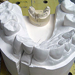 Dental impression cast and  plaster carving enlargment 2008